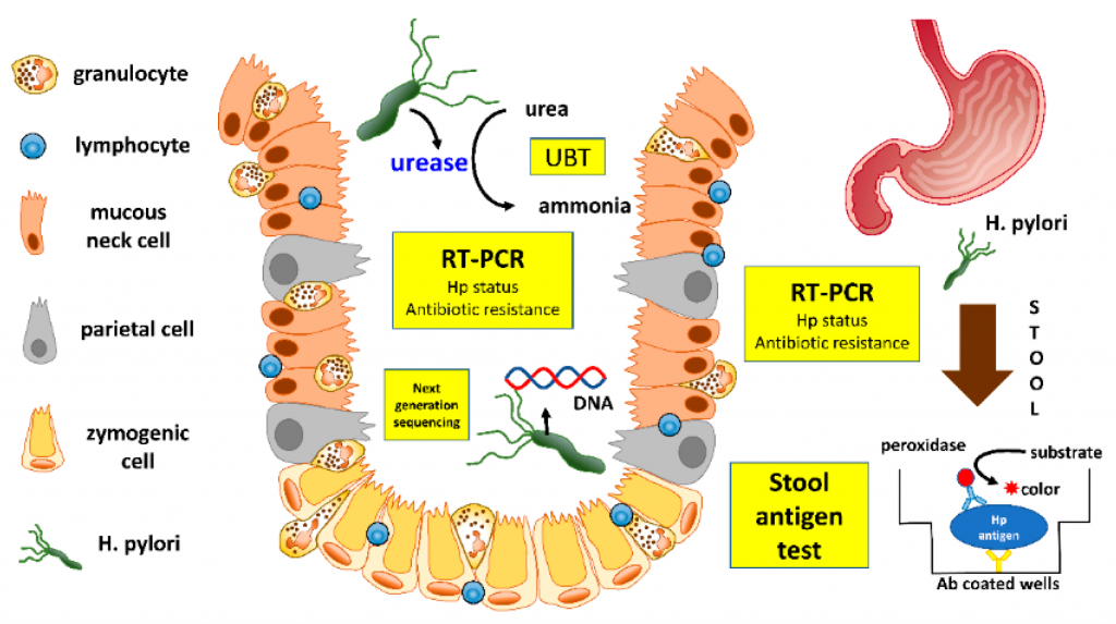 Helicobacter Pylori Detection MethodInvasive Detection