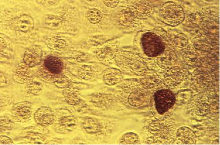 Chlamydia trachomatis in brown