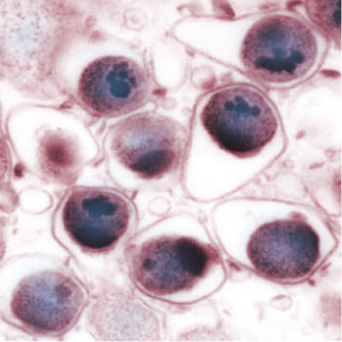 Chlamydophila pneumoniae particles
