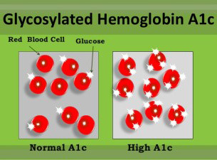 The glycosylated hemoglobin A1c