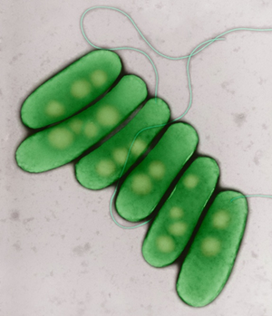 Legionella Pneumophila Antigens