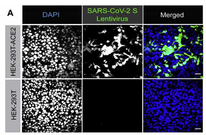 Typical Data for Lentiviral SARS-CoV-2 Pseudovirus