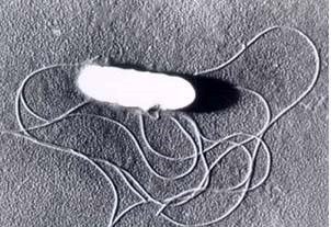 Listeria monocytogenes with flagella observed with a SEM