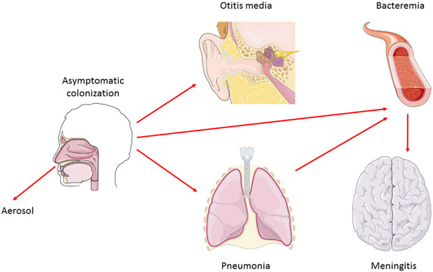 The life cycle of Streptococcus pneumoniae and the pathogenesis of pneumococcal disease