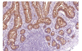 IHC/Pathology Antibodies