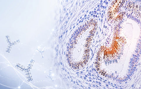 IHC/Pathology Antibodies
