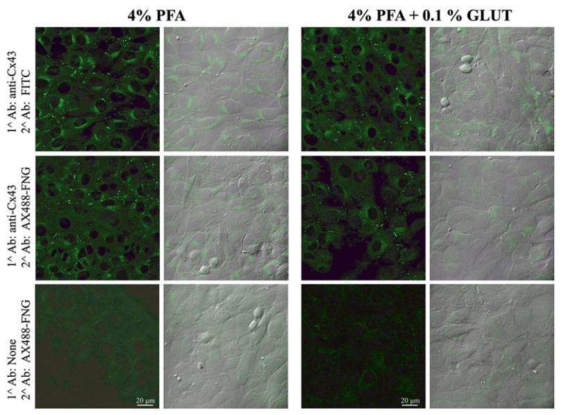 Correlative Microscopy Protocol for Localization of Proteins In Situ
