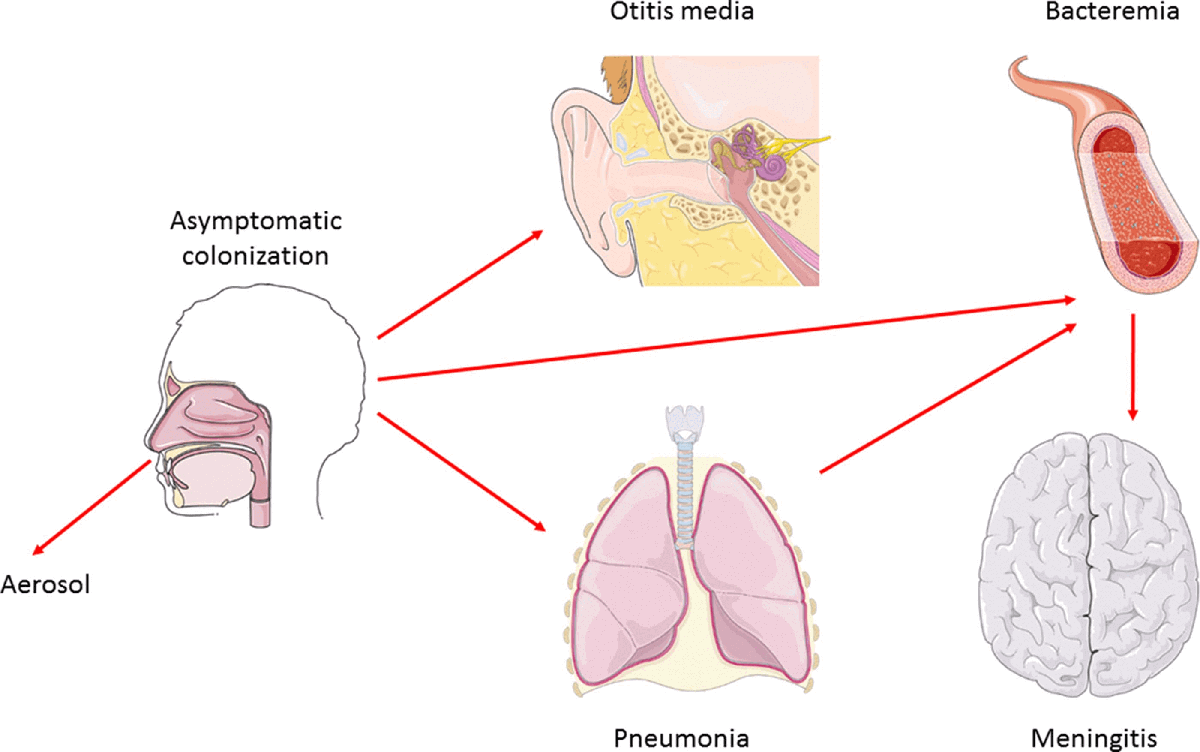 Inactivated Streptococcus Pneumoniae Antigens Creative Diagnostics