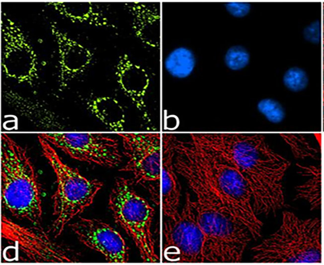 Rabbit Monoclonal Antibodies Creative Diagnostics