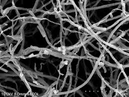 Streptomyces Avidinii antigen
