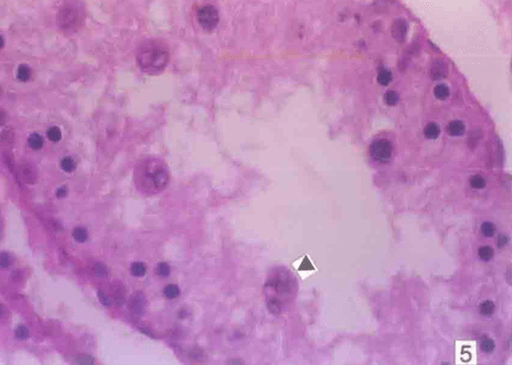 Testicular section from U. urealyticum -infected rat stained by HE