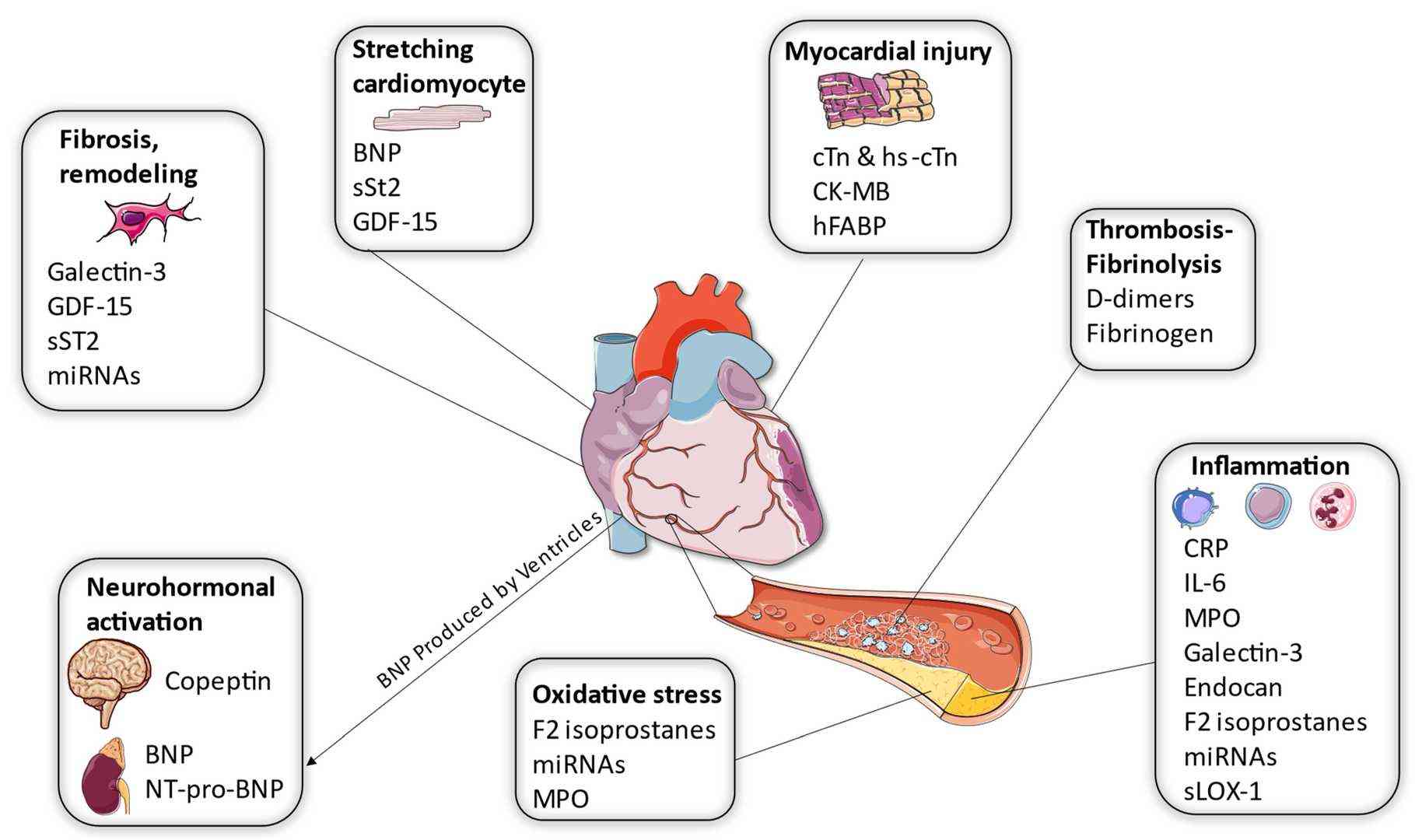 analyzing-myocardial-injury-biomarkers-with-elisa-creative-diagnostics