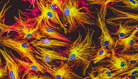 Control Antibodies 1