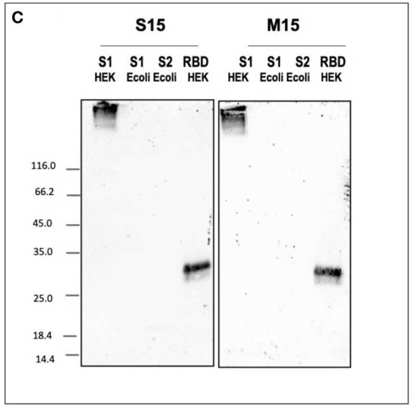 The specificity of M15 and S15 was evaluated using Western blotting. Both antibodies bind spike protein recombinant S1 subunit and RBD domain produced in HEK293F cells.  (Loïc Faye, <i>et al</i>, 2024)
