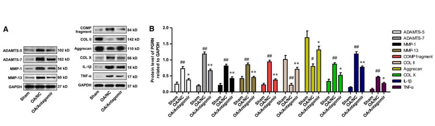 Protein levels of catabolic biomarkers (ADAMTS5, -7, MMP-1, -13 and COMP fragment), anabolic biomarkers (COL II and Aggrecan), the hypertrophic chondrocyte marker (COL X) and inflammatory cytokines (IL-1b and TNF-a). (Lingqiang Chen, <i>et al</i>, 2017)