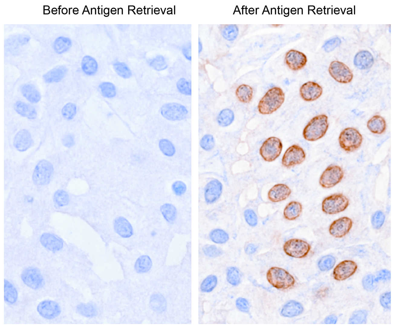 Effective Antigen Retrieval Creative Diagnostics