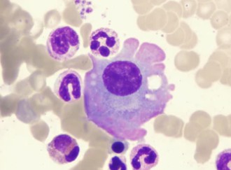 Chemotherapy