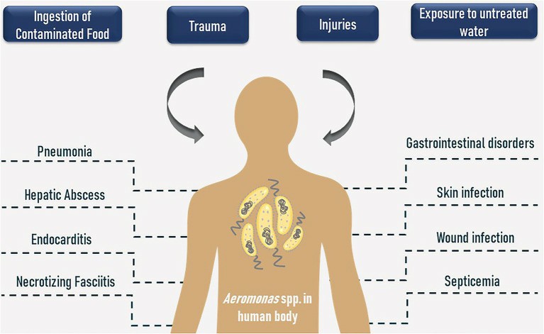 Contamination routes and human health disorders caused by Aeromonas spp.