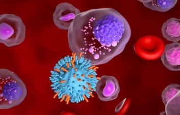 Plasma Cell Myeloma