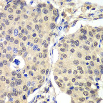 Rabbit Anti-CCNC Polyclonal Antibody