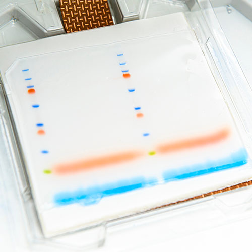 Western blot