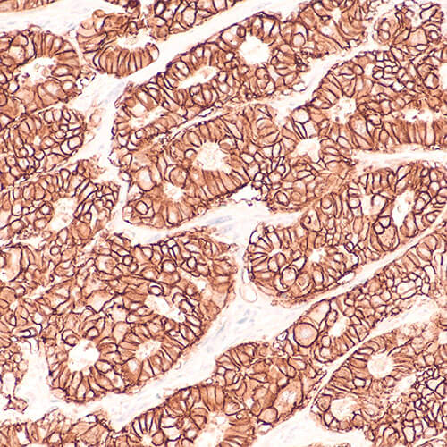 Immuno-histochemistry