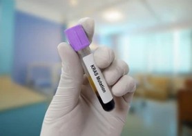 Small Cell Lung Cancer
