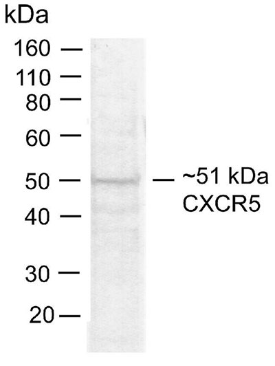 Anti-Human CXCR5 monoclonal antibody